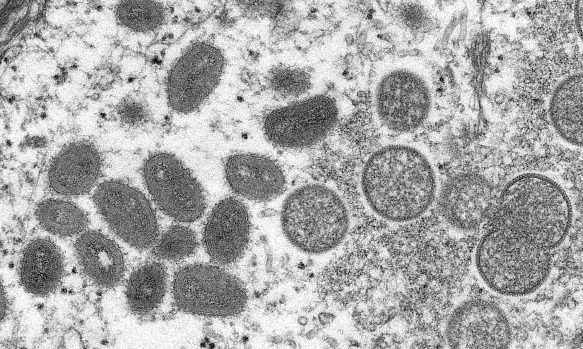 SES determina estado de emergência pública em Goiás devido a varíola dos macacos
