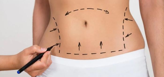 5 motivos para fazer cirurgia plástica no inverno