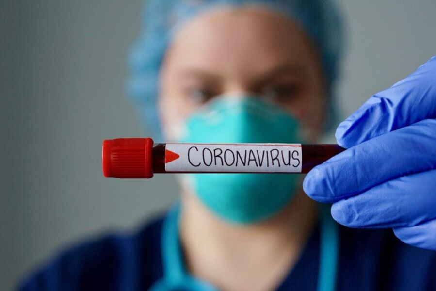 Covid-19: Brasil tem 55.908 casos e 180 mortes em 24 horas