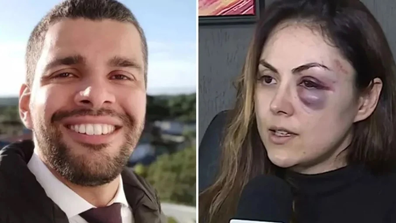 Procurador que espancou chefe tem esquizofrenia, conclui laudo