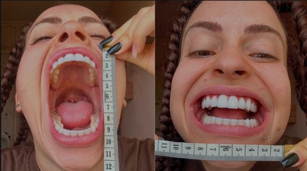 Jovem brasileira busca bater recorde de maior boca feminina do mundo