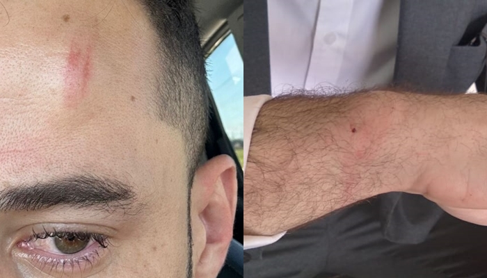 Advogado é agredido por policial ao visitar cliente na prisão