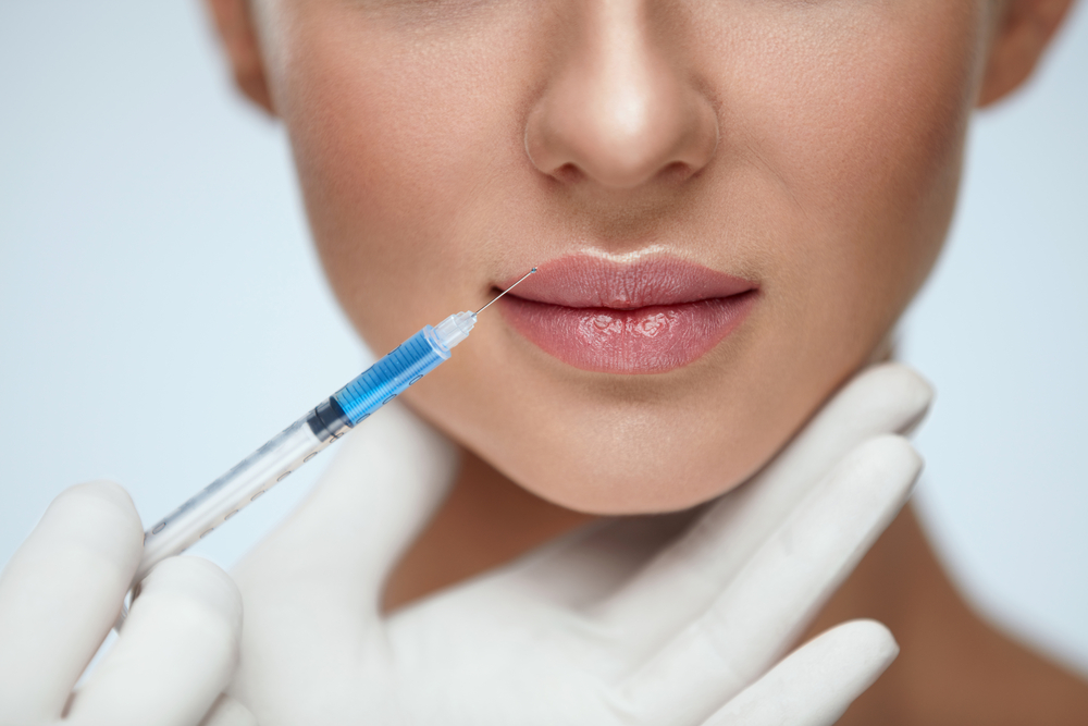Descubra a Beleza dos Seus Lábios: Preenchimento Labial Revelado