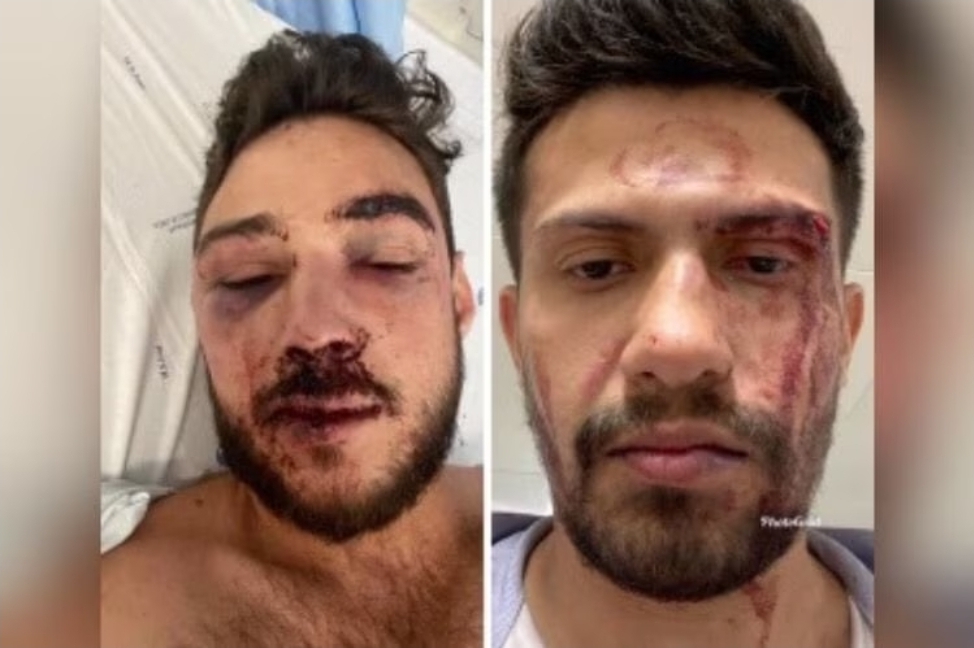 Casal gay brasileiro agredido em Lisboa pede justiça