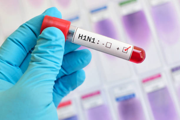 Casos de H1N1 crescem entre adultos; diagnósticos de covid-19 caem