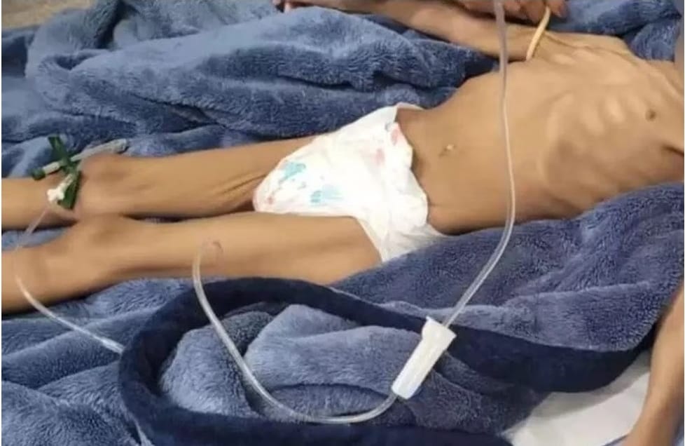 Pai que deixou filha de 3 anos há mais de 40 dias sem comer é solto; MP recorre
