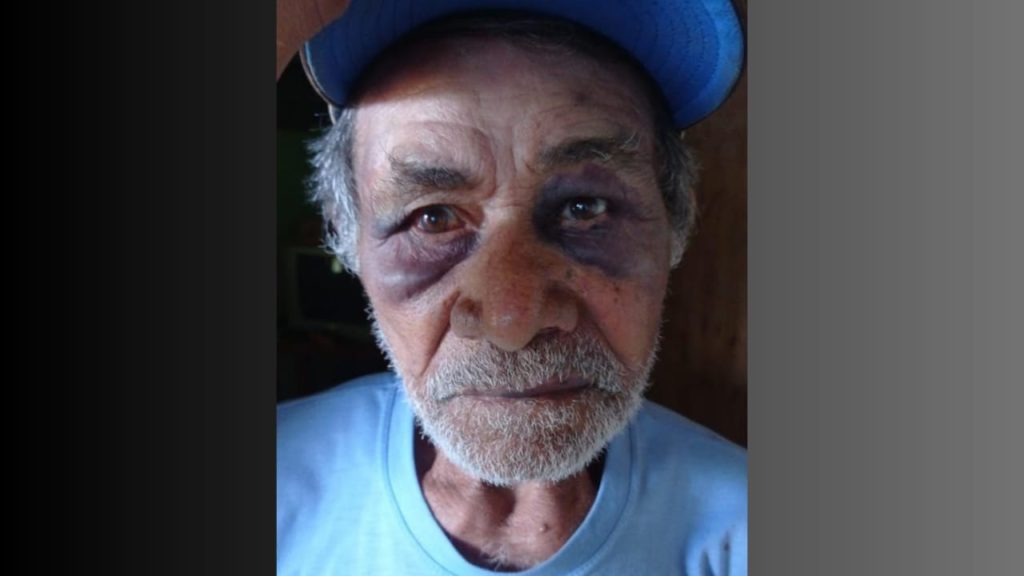Idoso agredido morre após ficar 14 dias na UTI, em Catalão