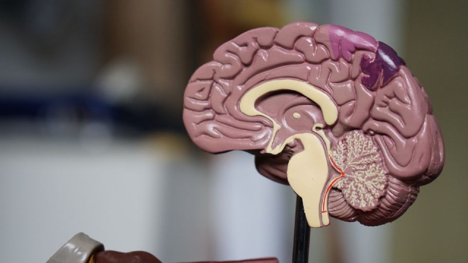 Alzheimer: remédio da Eli Lilly retarda avanço da doença, mostra estudo