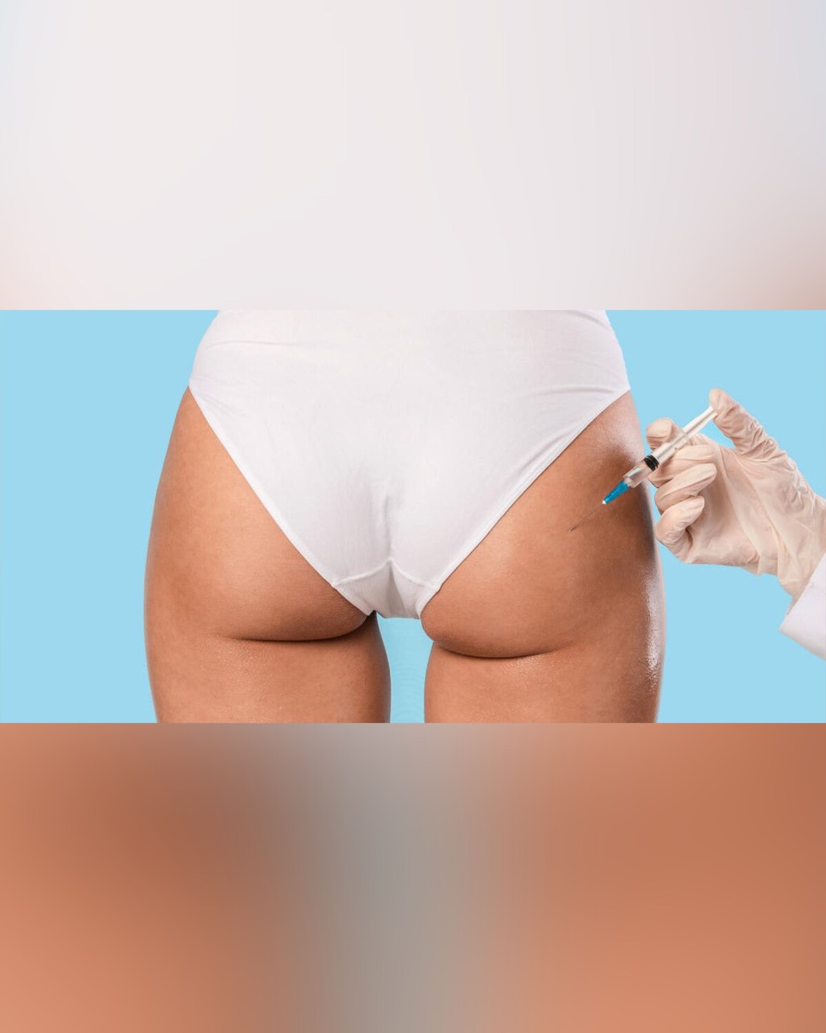 Biosculpt: Descubra o Segredo da Bioestimulação para Glúteos Esculpidos e Sensuais