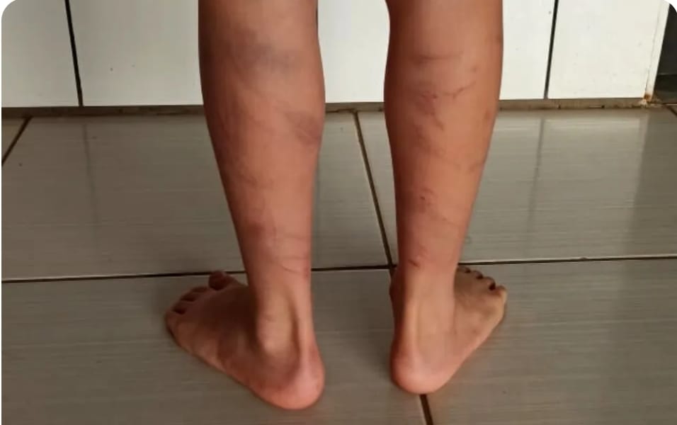 Filho é agredido pelo pai após assistir a conteúdo pornográfico