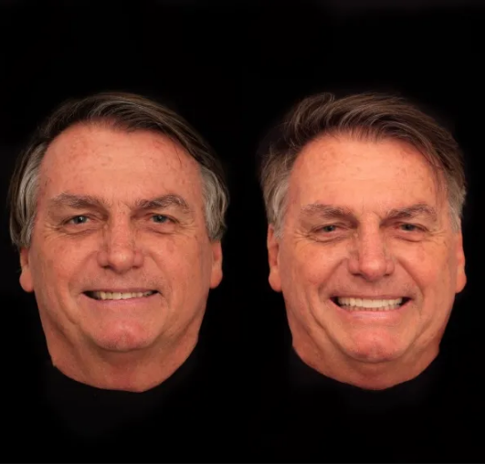 Jair Bolsonaro faz harmonização facial com dentes de R$3 mil