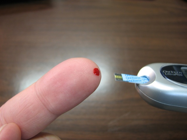 Diabetes é responsável por mais de 28 amputações por dia, no Brasil