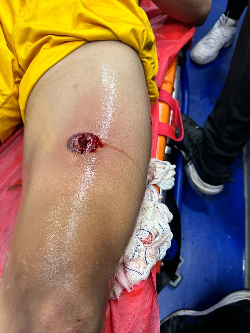 Goleiro é baleado por PM durante confusão na Divisão de Acesso