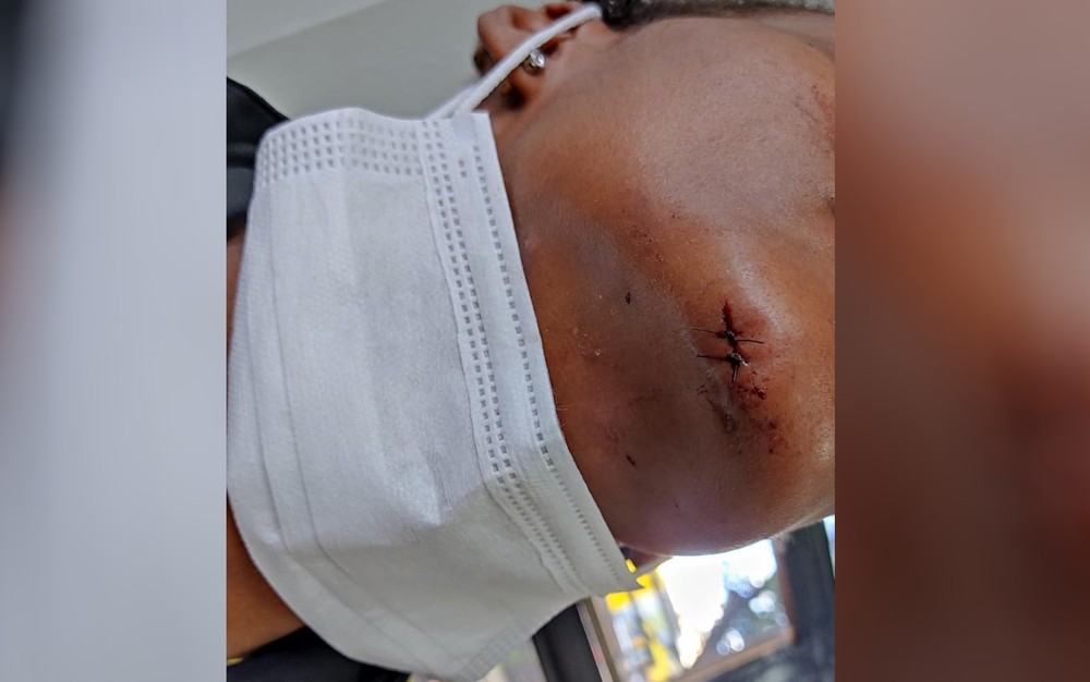 Marido é preso em flagrante por agredir a esposa e tentar matá-la queimada em Goiânia