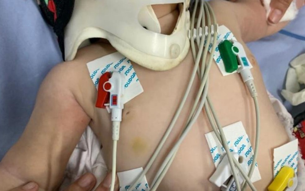 Pai de bebê internada com mais de 30 lesões no corpo é preso, em Anápolis