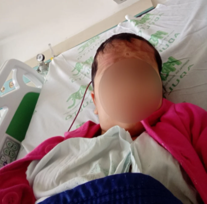Após progressiva capilar, garota de 9 anos é internada e passa por cirurgia