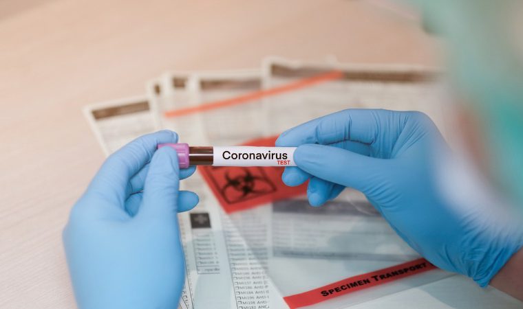 Goiás registra mais 142 casos de covid-19 em 24 horas
