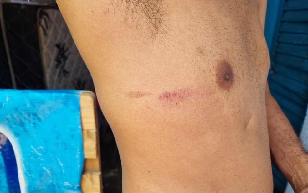 Integrante do Movimento Nacional de População de Rua, é agredido por PMs, além de ter a casa invadida