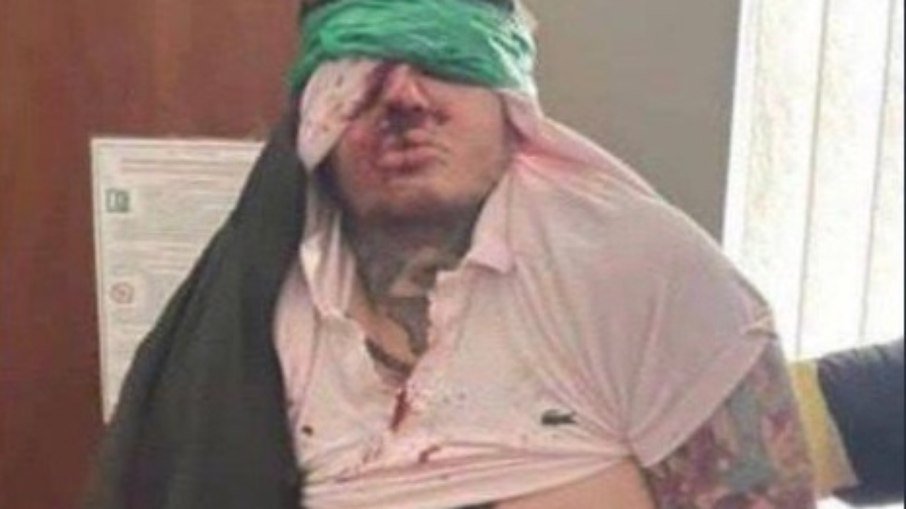 Lutador de MMA é torturado e morto por grupo neonazista