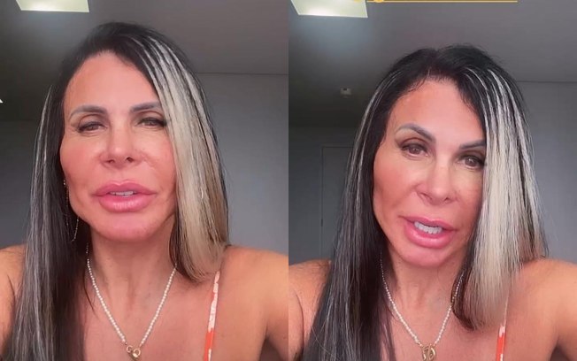 Gretchen fala sobre críticas dos internautas após harmonização facial