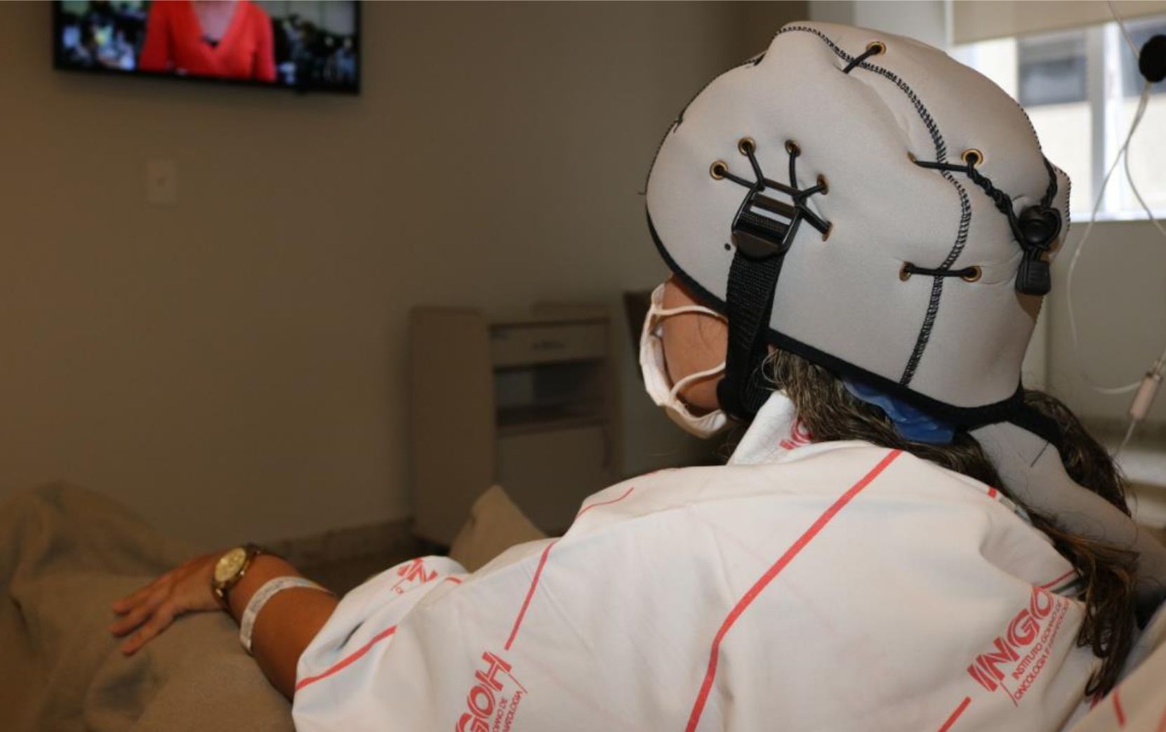 Pacientes de câncer pelo SUS terão acesso à tecnologia que reduz queda de cabelo
