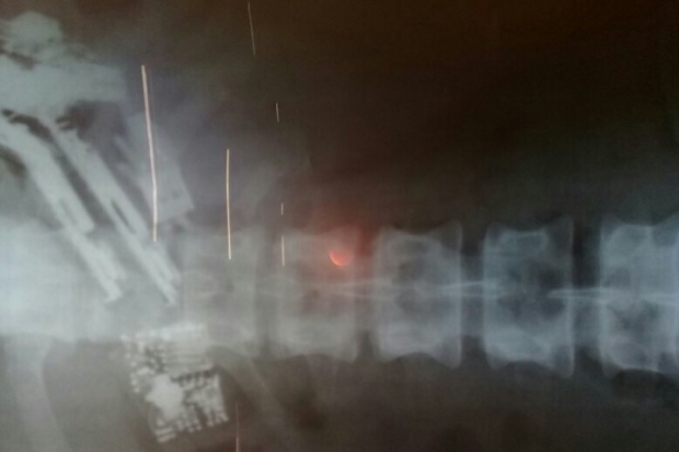 Detento engole cinco celulares e carregadores