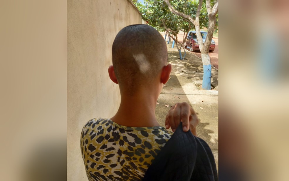 Adolescente é preso por agredir e raspar cabelo de namorada à força