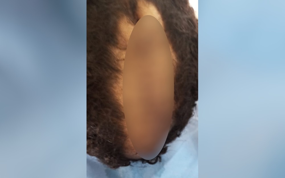 Criança é agredida pelo pai, por corte de cabelo no DF