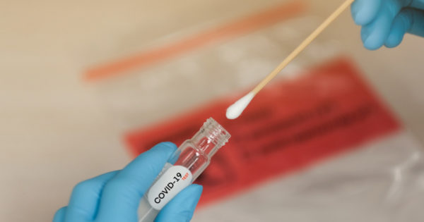 Goiás ultrapassa 128 mil casos de Covid-19