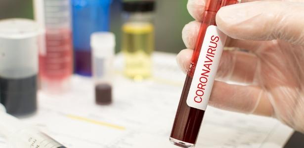 Goiás registra mais duas mortes por Covid-19