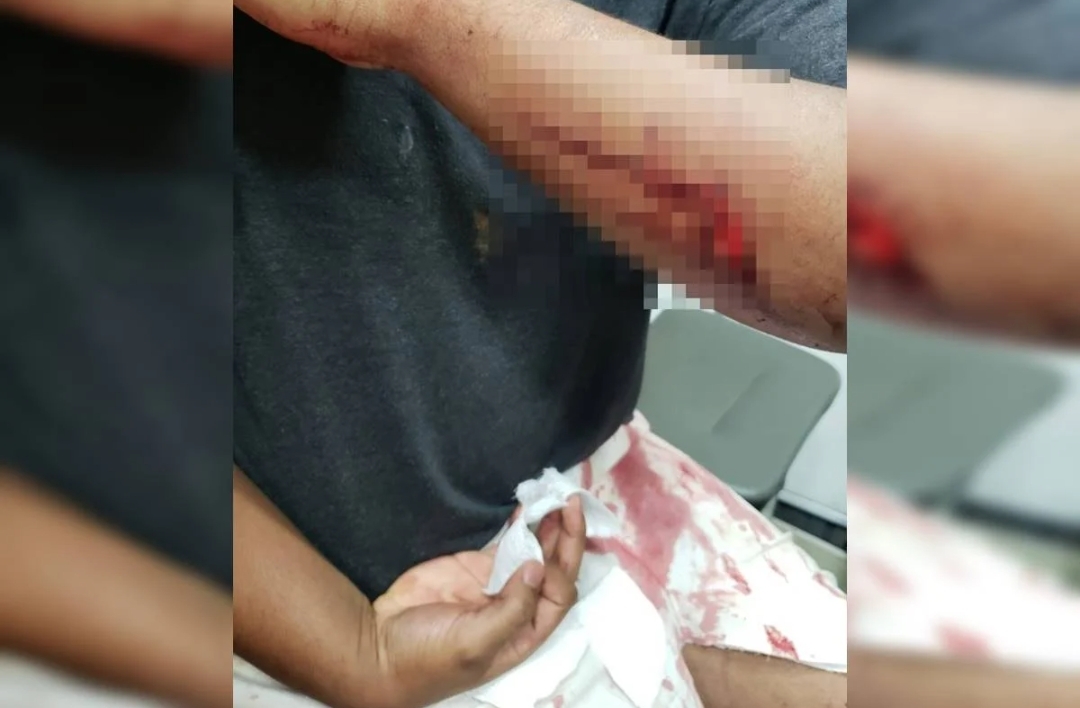 Netos são agredidos com facão pelo avô no DF
