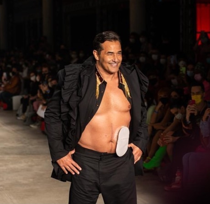 Luciano Szafir desfila com bolsa de estomia na SPFW