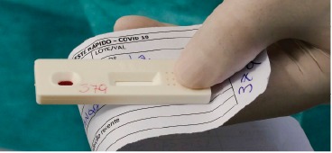 Testes positivos estão  em queda no Brasil
