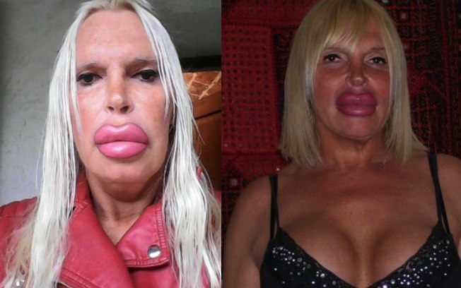 Mulher transgênero já gastou mais de R$300 mil em busca do corpo perfeito