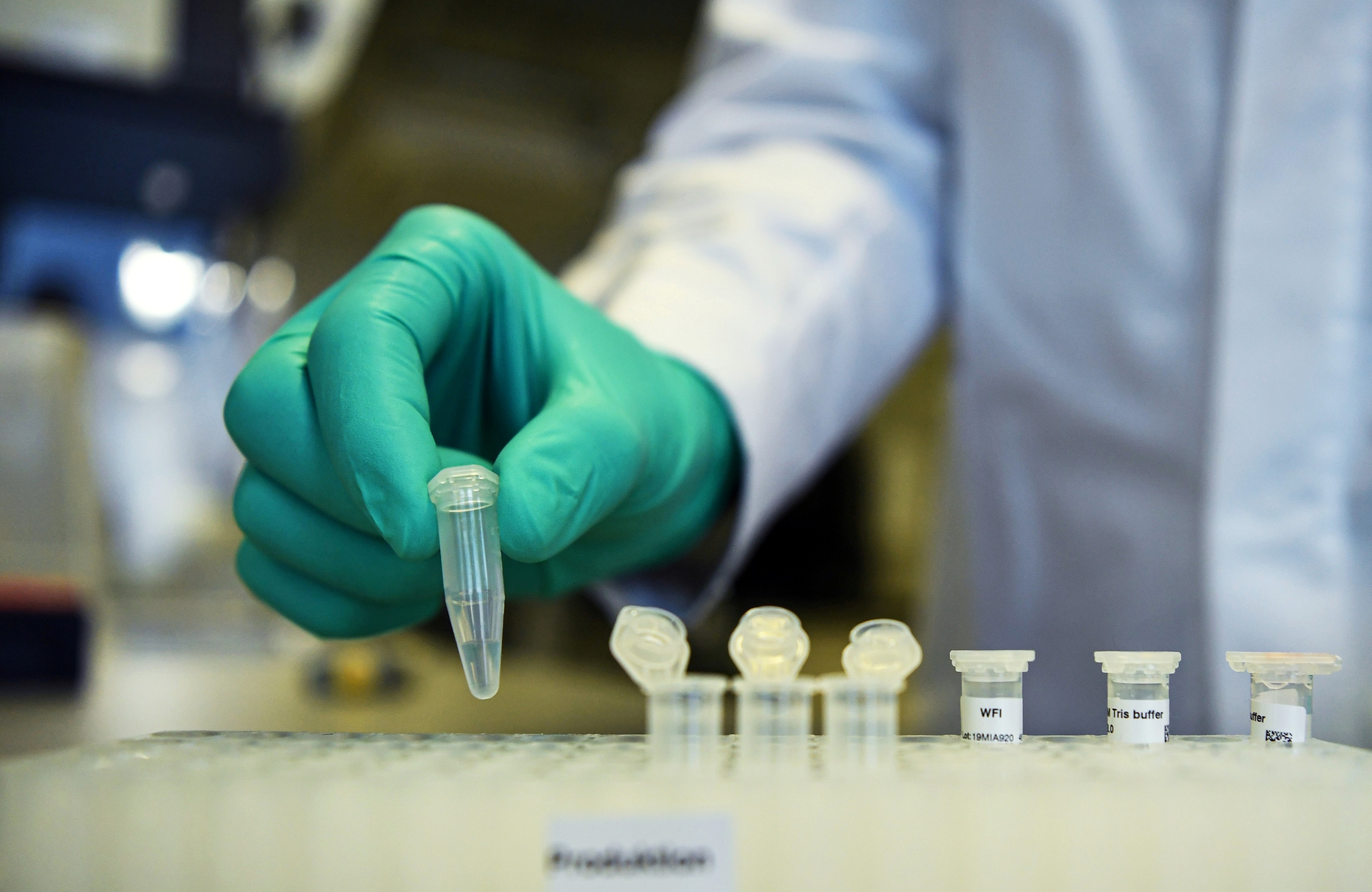 Primeiro caso de reinfecção por Covid-19 é confirmado por cientistas