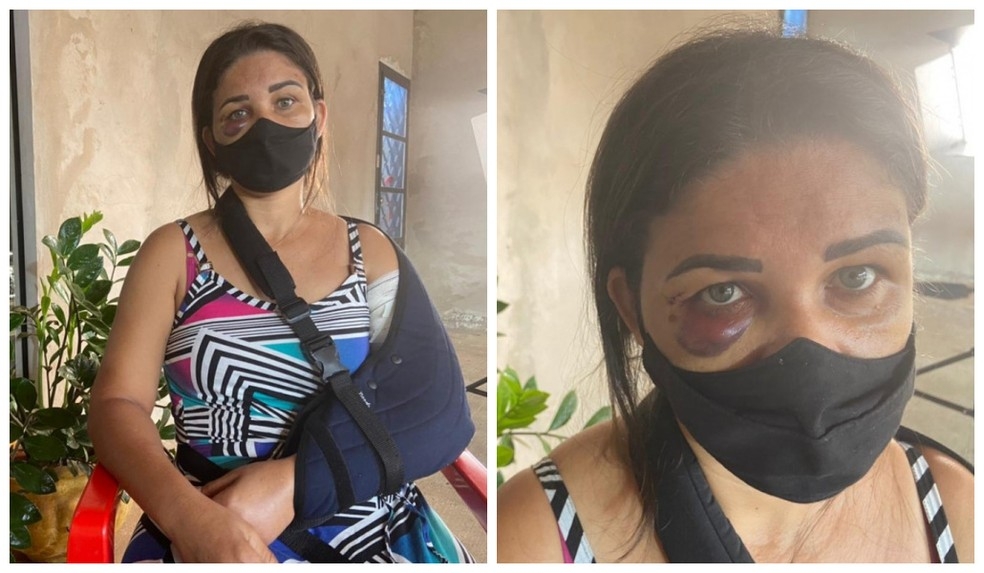 Cliente quebra o braço de uma funcionária ao se recusar usar máscara