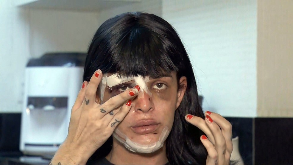 Homem que espancou modelo trans é reconhecido por fotos