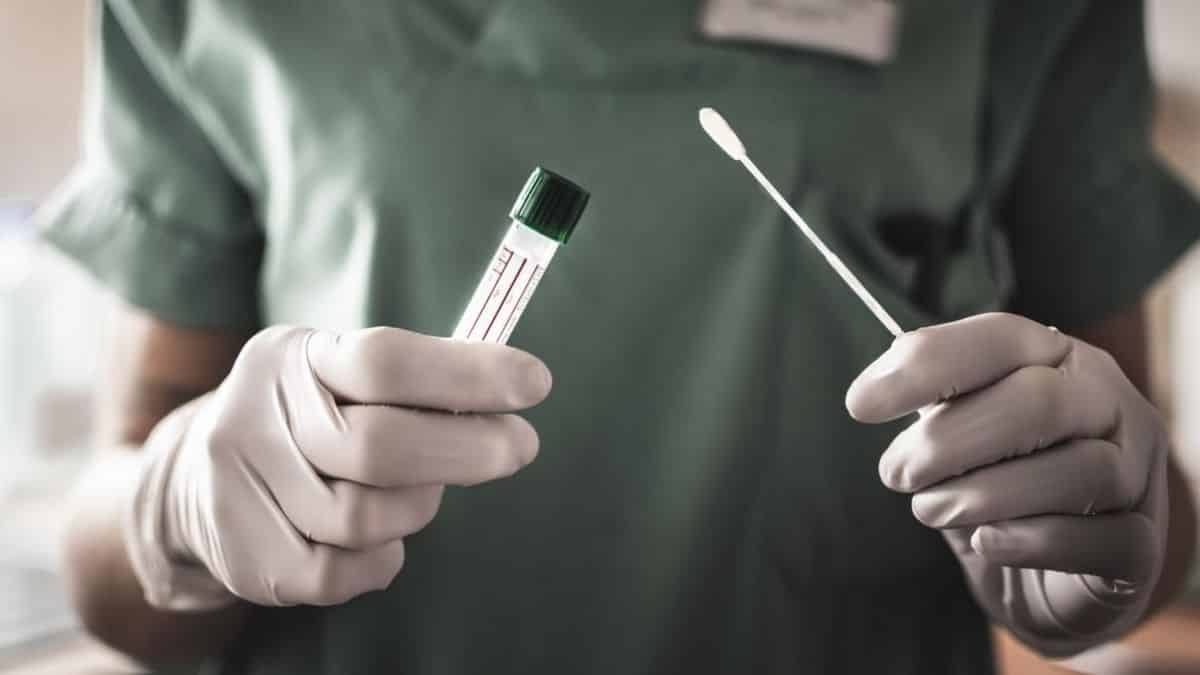 ANS inclui testes de covid-19 obrigatórios em planos de saúde
