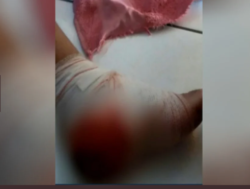 Secretário municipal é baleado por agentes policiais durante abordagem