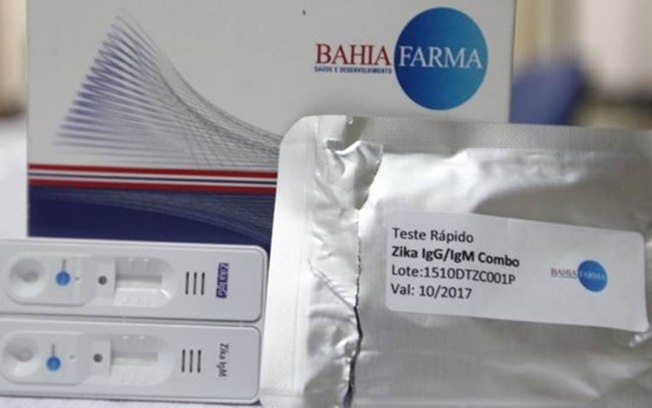 Ministro da Saúde avalia qualidade de teste de zika que será distribuído pelo SUS