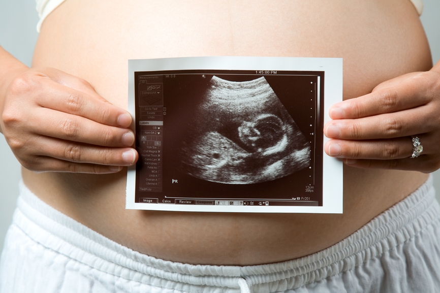 Mutirão de Ultrassom Feminina é realizado em Goiânia