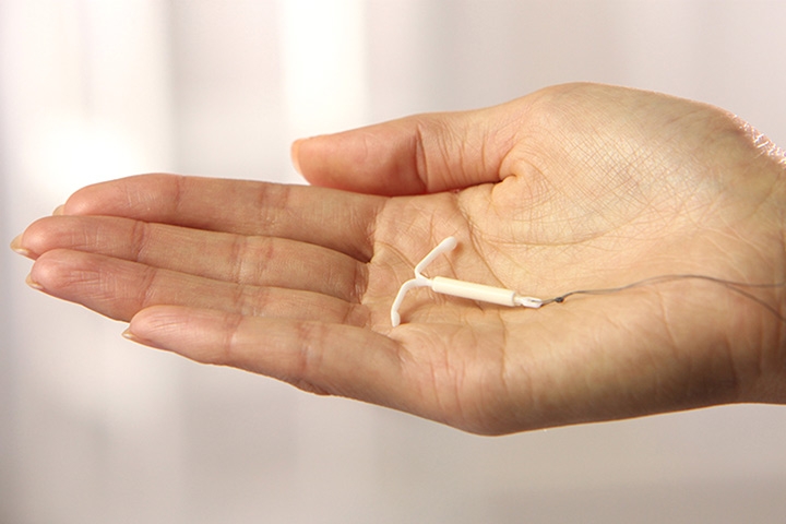 Ministério amplia acesso ao contraceptivo DIU no Sistema Único de Saúde