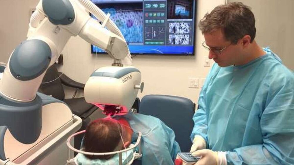 Artas: O robô que revolucionou o transplante de cabelo
