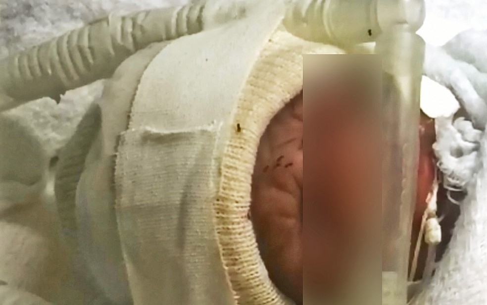 Incubadora de recém-nascido é invadida por formigas e servidores denunciam negligência