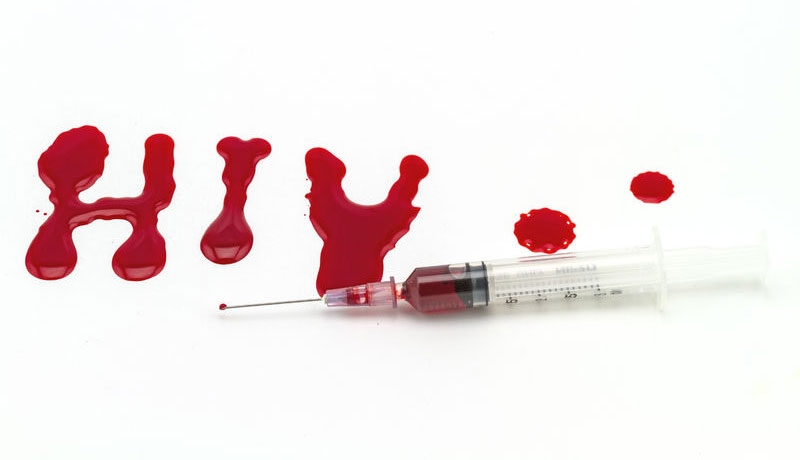 A exigibilidade do teste de HIV nos concursos públicos é constitucional?