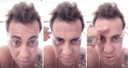 Thammy reclama da “careca” e namorada diz para ele fazer “implante”