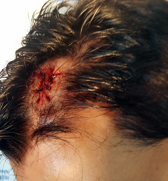 Policiais são agredidos ao tentar controlar uma festa no DF