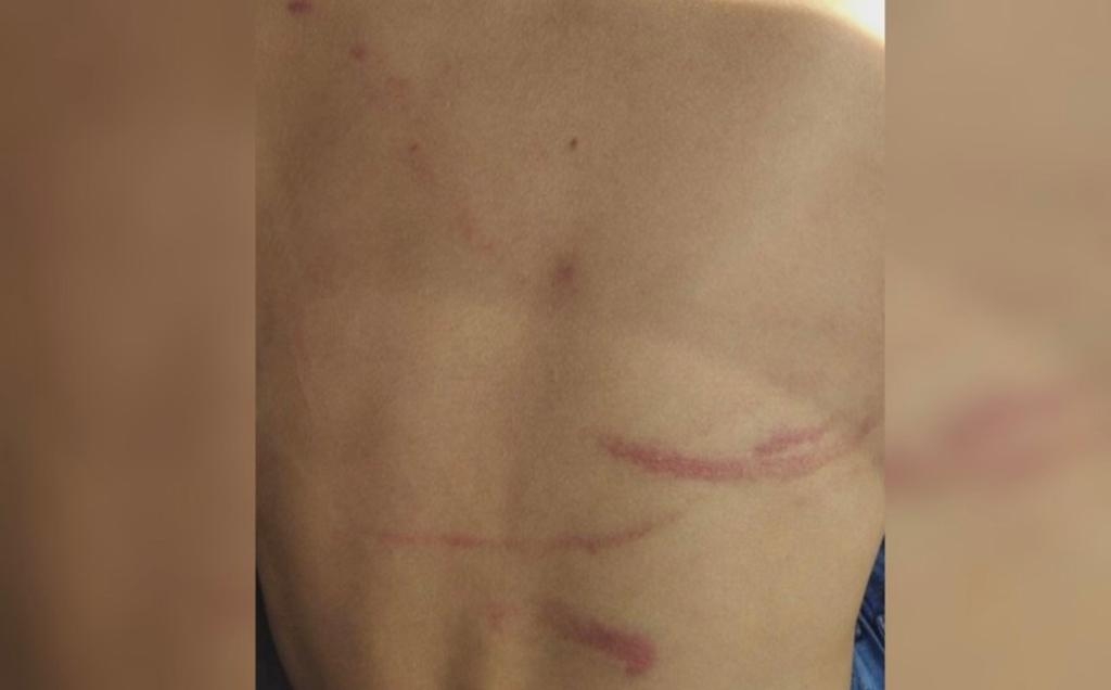 Homem é suspeito de agredir o filho com corda de varal em Goiás