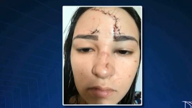 Cantor é suspeito de agredir ex-mulher com garrafa de cerveja