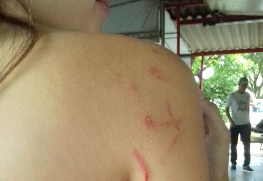Acusada de furar fila em mercado, adolescente é agredida por casal